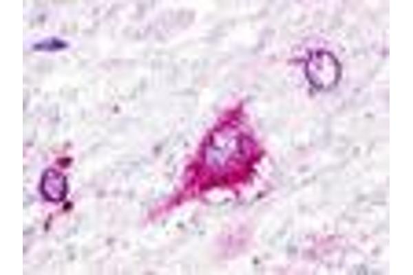 GPR22 抗体  (Cytoplasmic Domain)