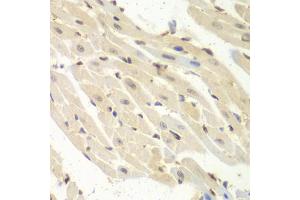 Immunohistochemistry of paraffin-embedded mouse heart using PSME1 antibody (ABIN5973094) at dilution of 1/100 (40x lens). (PSME1 抗体)