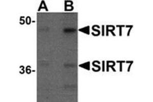 Western blot analysis of SIRT7 in 293 cell lysate with SIRT7 antibody at (A) 0. (SIRT7 抗体  (N-Term))