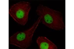 Fluorescent image of U251 cell stained with PR antibody at 1:25.