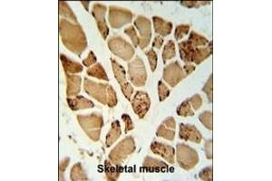 5NT1A Antibody (N-term) (ABIN653871 and ABIN2843123) IHC analysis in formalin fixed and paraffin embedded skeletal muscle followed by peroxidase conjugation of the secondary antibody and DAB staining. (NT5C1A 抗体  (N-Term))