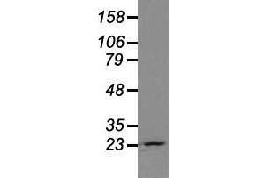 Western blot analysis of extracts (35 µg) from 9 different cell lines by using anti-NEUROG1 monoclonal antibody. (Neurogenin 1 抗体)