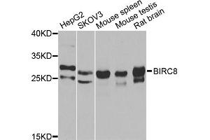 Western blot analysis of extracts of various cell lines, using BIRC8 antibody (ABIN2561421) at 1:1000 dilution. (ILP-2 抗体)