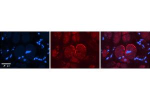 Rabbit Anti-GRIN2C Antibody    Formalin Fixed Paraffin Embedded Tissue: Human Adult heart  Observed Staining: Membrane Primary Antibody Concentration: 1:100 Secondary Antibody: Donkey anti-Rabbit-Cy2/3 Secondary Antibody Concentration: 1:200 Magnification: 20X Exposure Time: 0. (GRIN2C 抗体  (N-Term))
