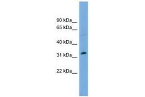 Image no. 1 for anti-PHD Finger Protein 13 (PHF13) (AA 179-228) antibody (ABIN6744908) (PHF13 抗体  (AA 179-228))