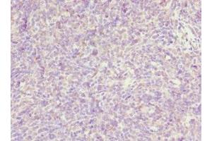 Immunohistochemistry of paraffin-embedded human thymus tissue using ABIN7162470 at dilution of 1:100 (TP53AIP1 抗体  (AA 1-108))