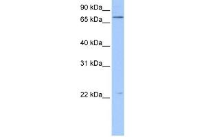 BFSP1 antibody used at 0. (Filensin 抗体  (N-Term))