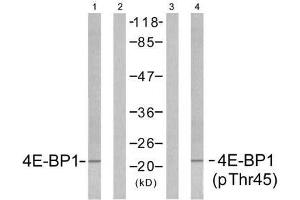Western blot analysis of extracts from MDA-MB-435 cells untreated or treated with EGF (200ng/ml, 5min), using 4E-BP1 (Ab-45) antibody (E021216, Lane1 and 2) and 4E-BP1 (phospho-Thr45) antibody (E011223, Lane 3 and 4). (eIF4EBP1 抗体)