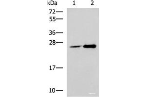 Western blot analysis of 293T cell lysates using DGCR6L Polyclonal Antibody at dilution of 1:800 (DGCR6L 抗体)