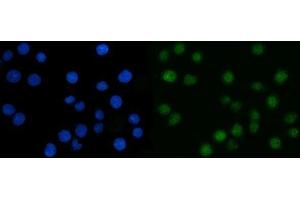 IF analysis of CSNK2A2 using anti-CSNK2A2 antibody (ABIN7602871).