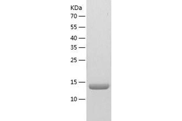 NME2 Protein (AA 1-152) (His tag)