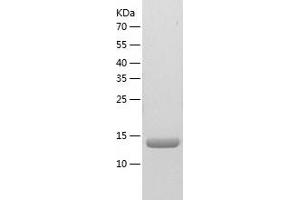 Western Blotting (WB) image for Nucleoside diphosphate kinase B (NME2) (AA 1-152) protein (His tag) (ABIN7124227) (NME2 Protein (AA 1-152) (His tag))