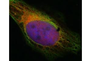 Indirect immunostaining of HELA cells with anti-syntaxin 7 (dilution 1 : 100; red) and mouse anti-α-tubulin (cat. (Syntaxin 7 抗体  (Cytoplasmic Domain))