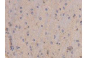 IHC-P analysis of Rat Brain Tissue, with DAB staining.