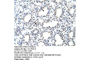 Rabbit Anti-THOC1 Antibody  Paraffin Embedded Tissue: Human Lung Cellular Data: Alveolar cells Antibody Concentration: 4. (THOC1 抗体  (C-Term))