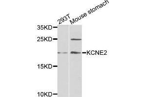 Western blot analysis of extracts of 293T and mouse stomach cells, using KCNE2 antibody. (KCNE2 抗体)
