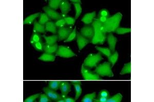 Immunofluorescence analysis of A549 cells using UBASH3B Polyclonal Antibody (UBASH3B 抗体)