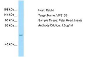 Image no. 1 for anti-Vacuolar Protein Sorting 13 Homolog B (Yeast) (VPS13B) (AA 76-125) antibody (ABIN6749989) (VPS13B 抗体  (AA 76-125))
