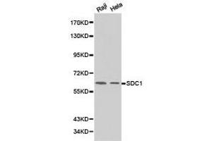 Western Blotting (WB) image for anti-Syndecan 1 (SDC1) antibody (ABIN1874708) (Syndecan 1 抗体)