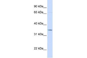TOLLIP antibody used at 1 ug/ml to detect target protein. (TOLLIP 抗体  (C-Term))