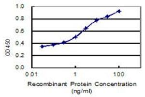 anti-Ankyrin Repeat and Sterile alpha Motif Domain Containing 4B (ANKS4B) (AA 1-417) antibody