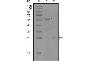 Western Blot showing PGR antibody used against truncated MBP-PGR recombinant protein (1) and truncated Trx-PGR (aa730-871) recombinant protein (2). (Progesterone Receptor 抗体  (AA 730-871))