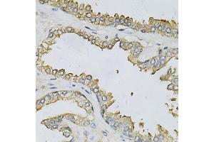 Immunohistochemistry of paraffin-embedded human prostate using APRT Antibody (ABIN6291536) at dilution of 1:100 (40x lens). (APRT 抗体)