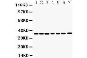 Anti- Annexin A3 Picoband antibody, Western blotting All lanes: Anti Annexin A3  at 0. (Annexin A3 抗体  (Middle Region))