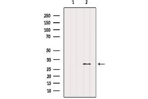 Western blot analysis of extracts from Mouse muscle, using E2F6 Antibody. (E2F6 抗体  (Internal Region))