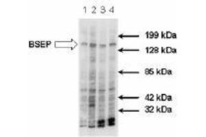 Image no. 1 for anti-ATP-Binding Cassette, Sub-Family B (MDR/TAP), Member 11 (ABCB11) antibody (ABIN187437) (ABCB11 抗体)