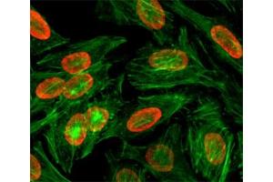 ICC/IF test of HeLa cells treated with sodium butyrate using recombinant H3K9me2 antibody (red).