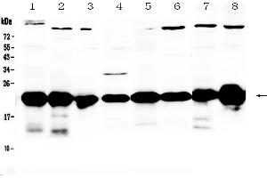 Western blot analysis of PARK7 / DJ1 using anti-PARK7 / DJ1 antibody . (PARK7/DJ1 抗体  (AA 2-189))