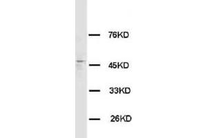 HRH3 Polyclonal Antibody (HRH3 抗体  (C-Term))