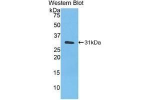 Detection of Recombinant CA3, Human using Monoclonal Antibody to Carbonic Anhydrase III, Muscle Specific (CA3) (CA3 抗体  (AA 2-260))
