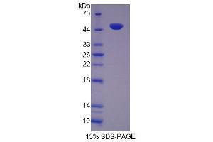 SDS-PAGE analysis of Mouse TUFT Protein. (TUFT1 蛋白)