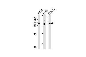 p27Kip1 Antibody (N-term S12) (ABIN1881620 and ABIN2838923) western blot analysis in A431,Hela,mouse C2C12 cell line lysates (35 μg/lane). (CDKN1B 抗体  (N-Term))