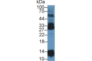 Western Blot; Sample: Human Lung lysate; Primary Ab: 1µg/ml Rabbit Anti-Human NME6 Antibody Second Ab: 0. (NME6 抗体  (AA 3-182))
