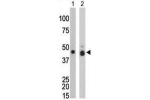 Western Blotting (WB) image for anti-Creatine Kinase, Brain (CKB) antibody (ABIN3002965) (CKB 抗体)