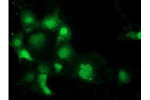 Anti-SPR mouse monoclonal antibody (ABIN2453680) immunofluorescent staining of COS7 cells transiently transfected by pCMV6-ENTRY SPR (RC205679). (SPR 抗体)
