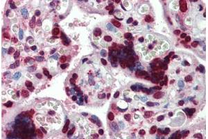 Human Placenta: Formalin-Fixed, Paraffin-Embedded (FFPE) (HMGA1 抗体  (AA 9-21))
