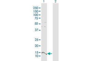 Parathymosin 抗体  (AA 1-102)