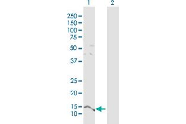 Parathymosin 抗体  (AA 1-102)