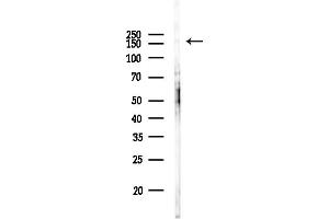 Western blot analysis of lysates from Rat brain, using Gli3 Antibody at 1/1000 dilution.