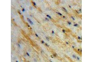 Used in DAB staining on fromalin fixed paraffin-embedded Heart tissue (Corin 抗体  (AA 521-637))