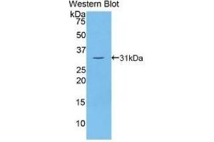 Detection of Recombinant Thyroglobulin, Human using Polyclonal Antibody to Thyroglobulin (TG) (Thyroglobulin 抗体  (AA 2083-2333))