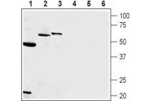 Presenilin 1 (PSEN1) peptide