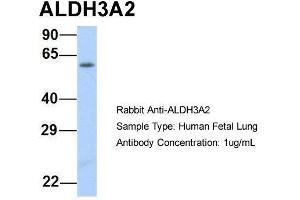 Host:  Rabbit  Target Name:  ALDH3A2  Sample Type:  Human Fetal Lung  Antibody Dilution:  1. (ALDH3A2 抗体  (Middle Region))
