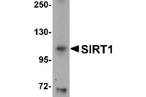 Western Blotting (WB) image for anti-Sirtuin 1 (SIRT1) (N-Term) antibody (ABIN1031567) (SIRT1 抗体  (N-Term))