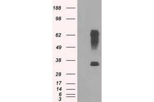 Western Blotting (WB) image for anti-Ring Finger Protein 144B (RNF144B) (AA 1-256) antibody (ABIN1490651) (RNF144B 抗体  (AA 1-256))