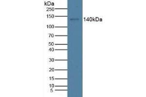 Detection of CTXI in Rat Stomach Tissue using Monoclonal Antibody to Cross Linked C-Telopeptide Of Type I Collagen (CTXI) (CTX-I 抗体)